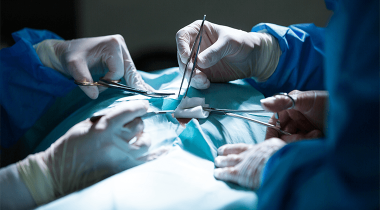 Creación de fístulas arteriovenosas para hemodiálisis